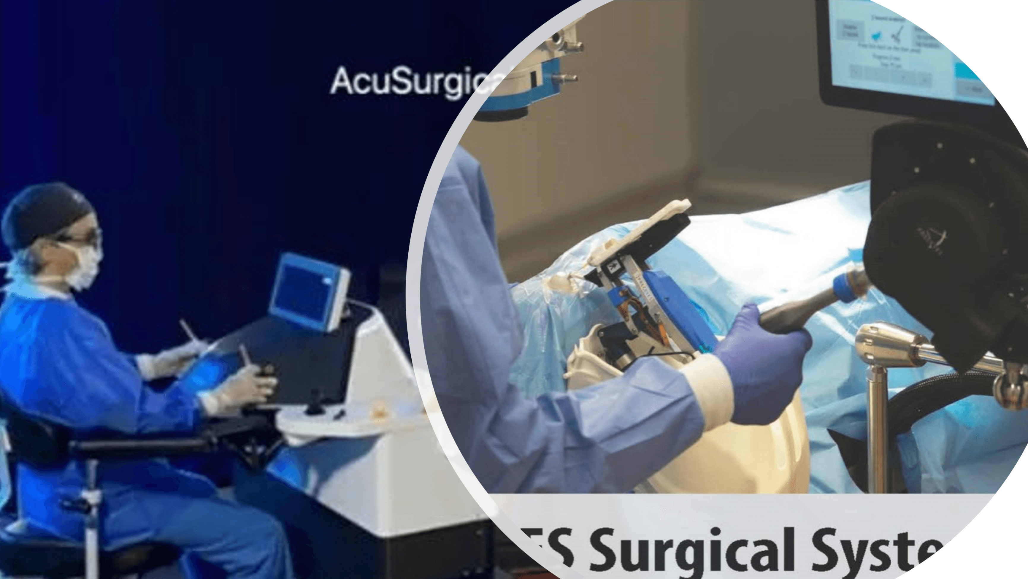 The Robotic Future Of Vision High Precision Breakthroughs And Embodied Ai Drive Ophthalmic Surgery Revolution